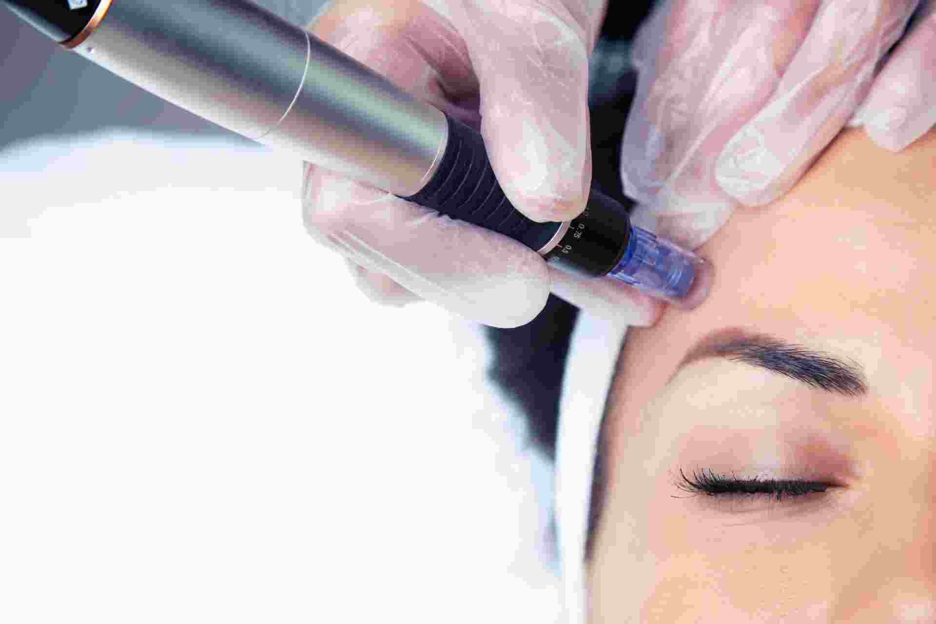 Your Radiant Best: Discover the World of Medi Facials and Microneedling with Dr. Aparna Krishna